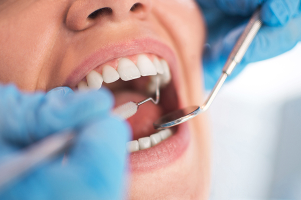 ¿Qué tipos de endodoncia hay?